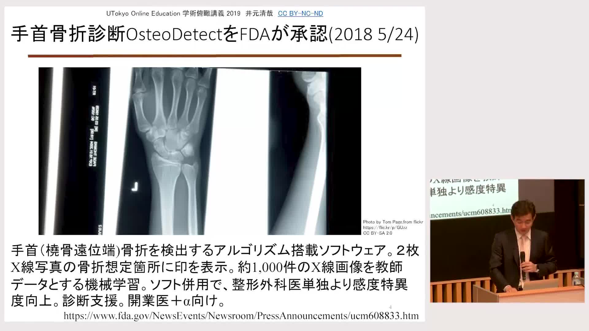 ゲノム情報と人工知能を用いた新しい時代のがん医療